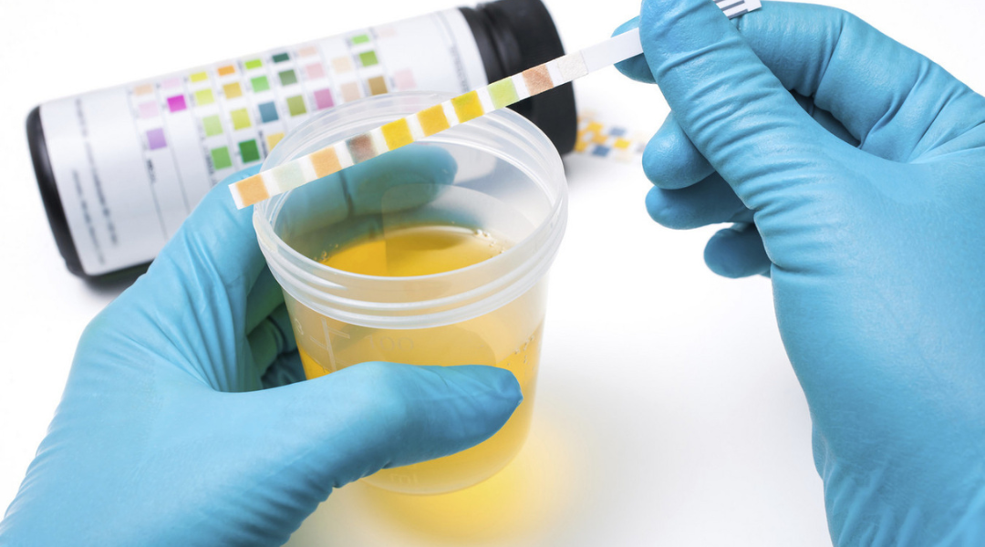 Dựa vào sự thay đổi của nước tiểu